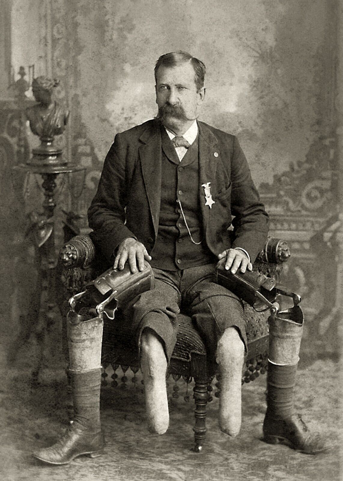 Antique Photo ... Civil War Vet Prosthetic Legs, Photo Reprint 5x7