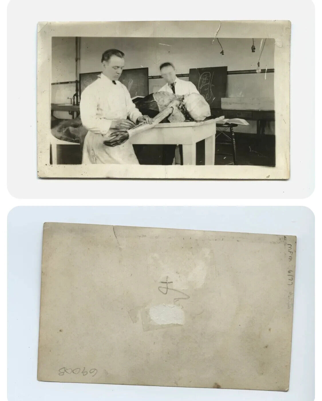 Medical Students & Dissection of Cadaver Antique / Vintage Photo