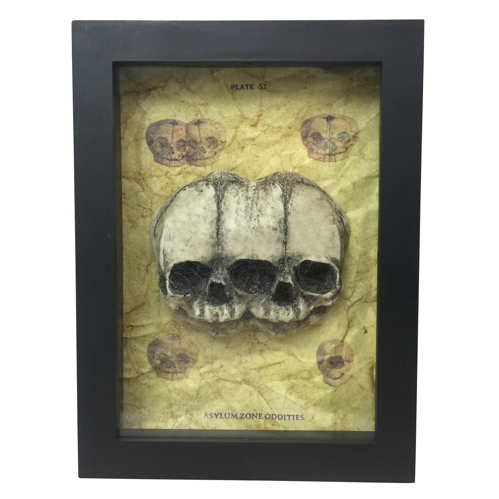 Siamese Twin Triclops Fetus Skull Frame Conjoined Vintage Fetal Medical Specimen