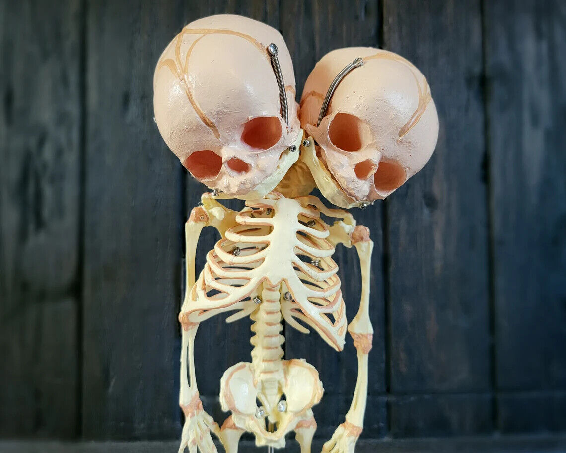 2 Headed Fetal Skeleton, Conjoined Twins Skeleton Model, 2 Head Baby, Oddities