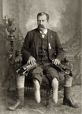 Antique Photo ... Civil War Vet Prosthetic Legs, Photo Reprint 5x7 picture