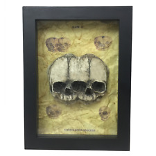 Siamese Twin Triclops Fetus Skull Frame Conjoined Vintage Fetal Medical Specimen picture